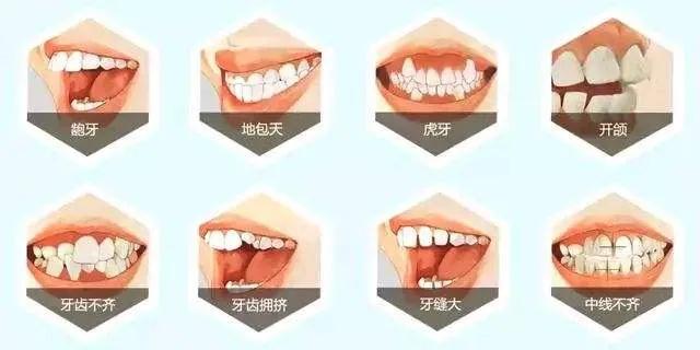 1595559721336023199.jpg 1595559721336023199.jpg